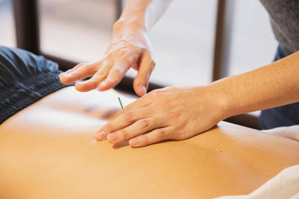 The hand of a person performing acupuncture on the back of a patient lying on their stomach.